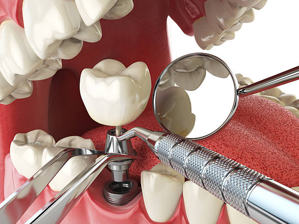 Best Emergency Dental Care for Trauma or Injury in Oakwood, GA